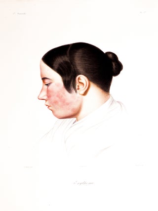 Lecons Sur Les Maladies de la Peau Professées à l’Ecole de Médecine de Paris..
