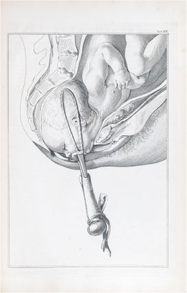Item #734 A Set of Anatomical Tables, with Explanations, and an Abridgement, of the Practice of...
