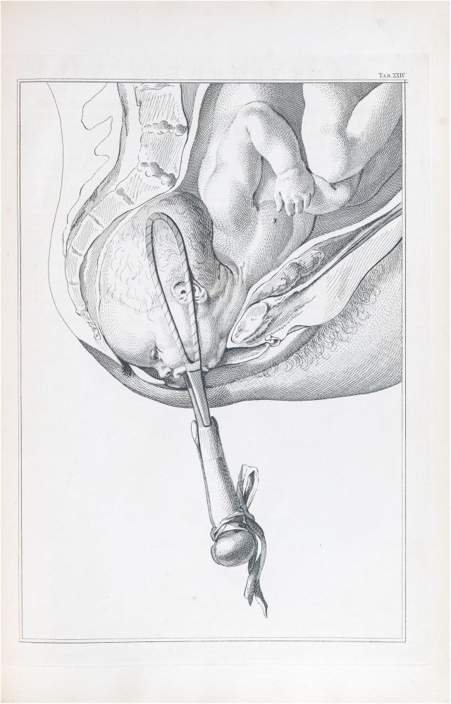 Item #734 A Set of Anatomical Tables, with Explanations, and an Abridgement, of the Practice of Midwifery. William Smellie.