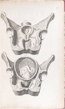 A Set of Anatomical Tables, with Explanations, and an Abridgement, of the Practice of Midwifery